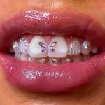 Formation Strass Dentaire en ligne
